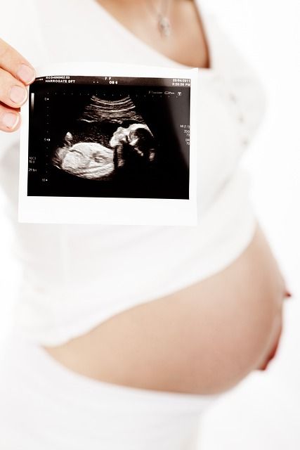 Fertilização in vitro - mulher grávida com ultrassom
