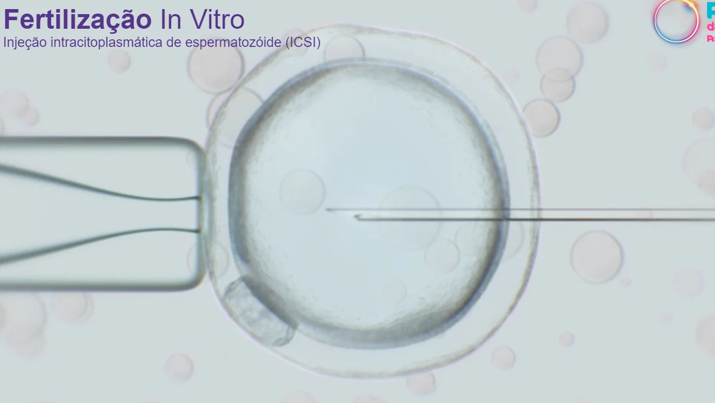 Fertilização in vitro